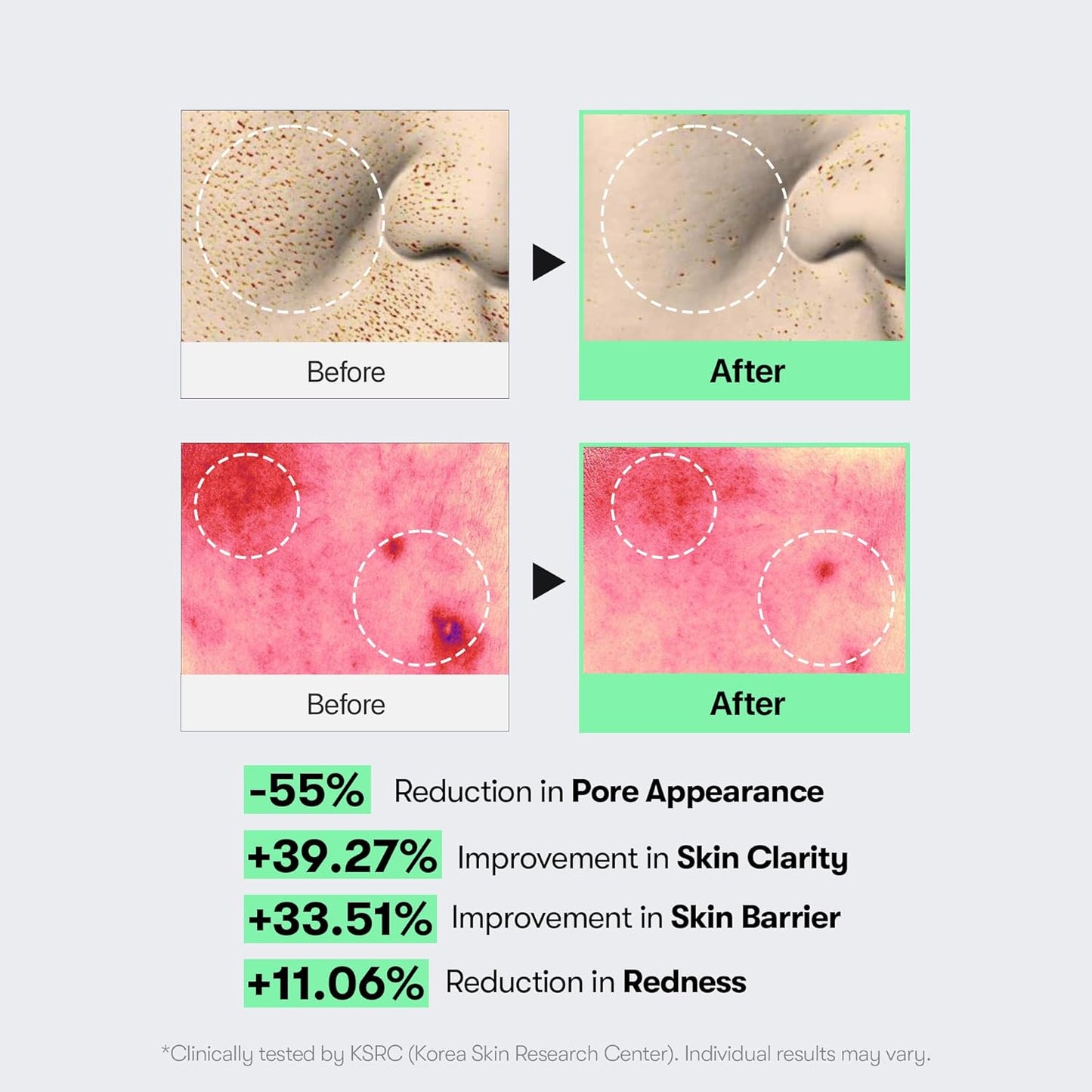 CICA Reedle Shot 100, Spicule Microneedling Serum for Pore Care & Exfoliation, Exosome, Centella Asiatica for Glass Skin, Skin Texture, Korean Liquid Skin Booster (1.69 Fl Oz / 50Ml)